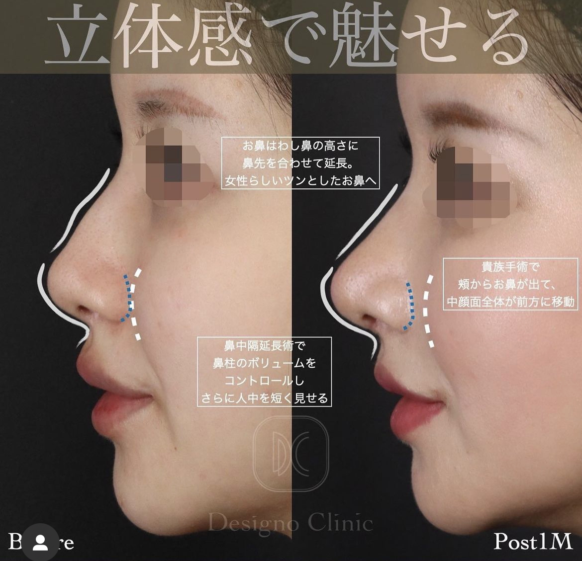 貴族
